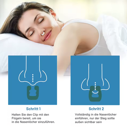 SnoreDelete™ - 8 Stück Anti-Schnarchclips