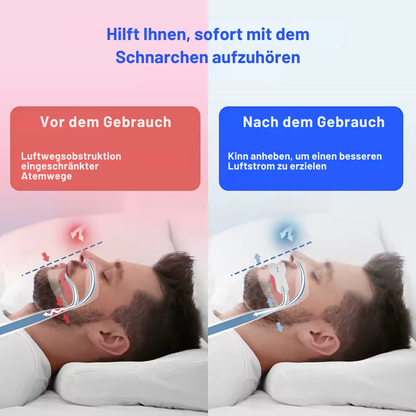 SnoreDelete™ - 8 Stück Anti-Schnarchclips